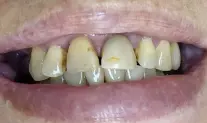 Фото пациента